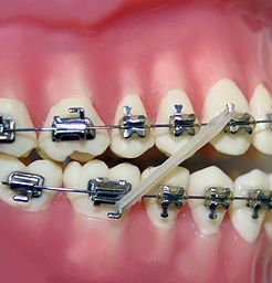 Elastics